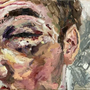 Black Eye, Ethan Friedberg